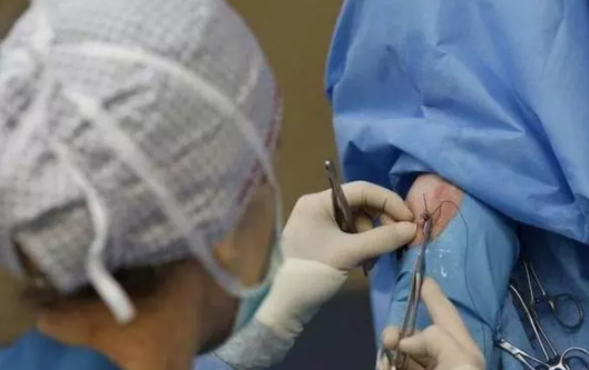 順產撕裂和側切哪個更疼 順產撕裂和側切哪個好恢復