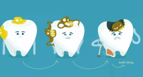 寶寶齲齒是因為吃糖嗎 影響齲齒的因素介紹