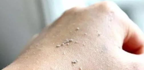 寶寶洗澡要不要搓泥 寶寶洗澡搓泥好不好