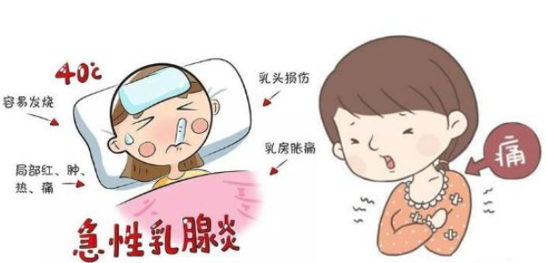 乳腺炎膿腫自行潰破怎么辦 乳腺炎膿腫自行潰破是好了嗎