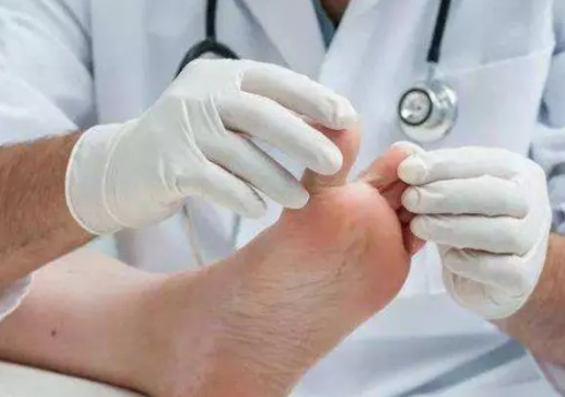 寶寶腳指甲往肉里長怎么辦 腳趾甲往肉里長怎么護理