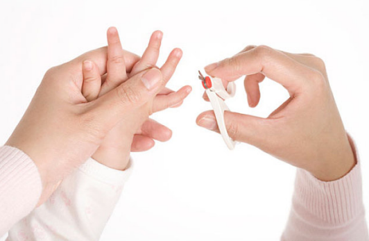 寶寶腳指甲往肉里長怎么辦 腳趾甲往肉里長怎么護理