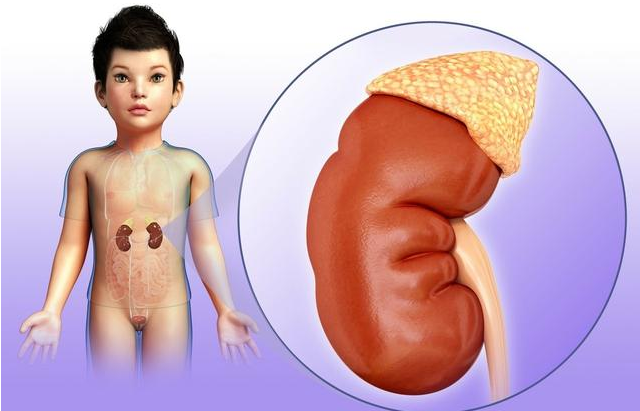 怎么看孩子的腎有沒有問題 哪些兒童容易出現腎病問題 怎么看孩子的腎有沒有問題 哪些兒童容易出現腎病問題
