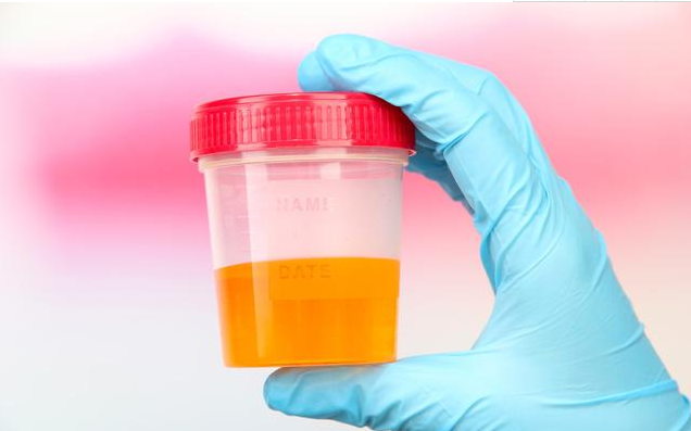 怎么看孩子的腎有沒有問題 哪些兒童容易出現腎病問題 怎么看孩子的腎有沒有問題 哪些兒童容易出現腎病問題