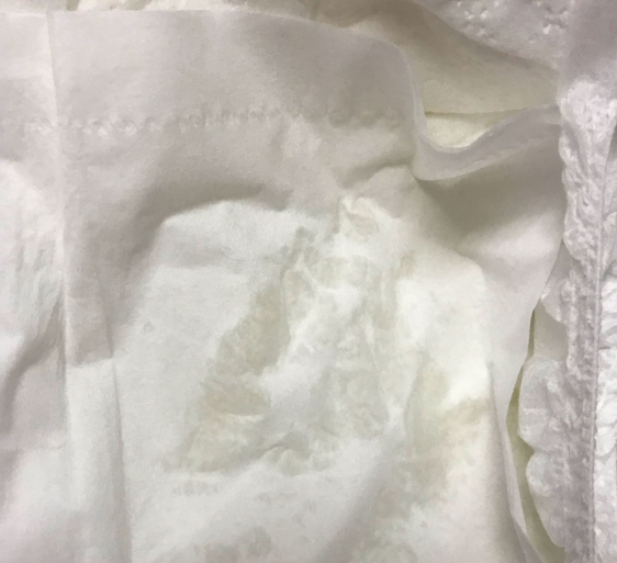 皮皮克紙尿褲適合夏天用嗎 皮皮克紙尿褲尺碼大小怎么樣