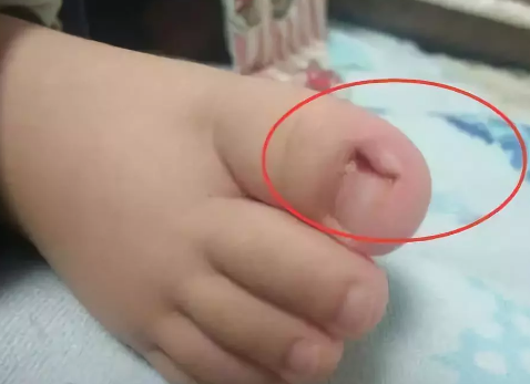 你真會給你的寶寶剪指甲嗎 如何給寶寶正確的剪指甲 你真會給你的寶寶剪指甲嗎 如何給寶寶正確的剪指甲