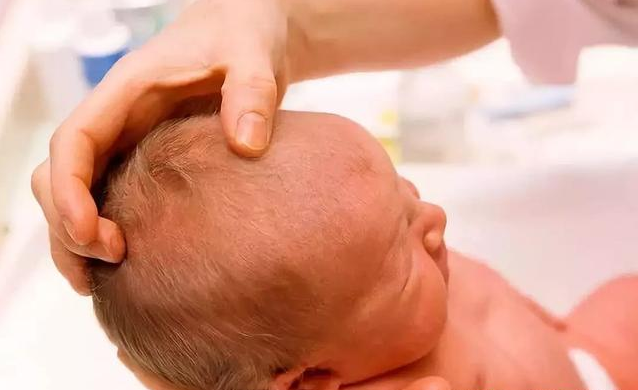 寶寶前囟門跳動正常嗎 囟門遲遲不閉合有什么危害