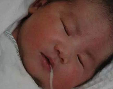 寶寶吐奶和溢奶的區(qū)別竟然這么大 嬰兒吐奶比溢奶嚴重嗎