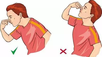 小孩子流鼻血怎么止住 孩子流鼻血處理方法