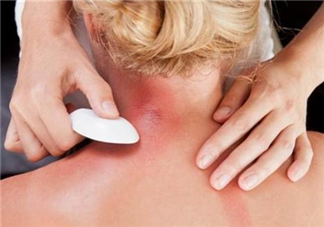 女性月經期間可以刮痧嗎 刮痧越用力越好嗎