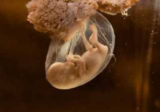 孕期為何要檢查羊水  孕期羊水問題匯總