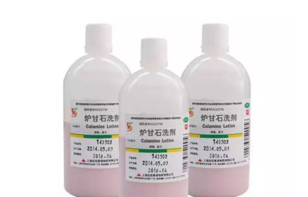 寶寶濕疹能用爐甘石洗劑嗎 寶寶用爐甘石洗劑后需要清洗嗎