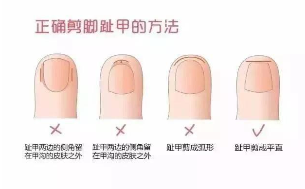 寶寶多久剪一次指甲 寶寶指甲該怎么剪