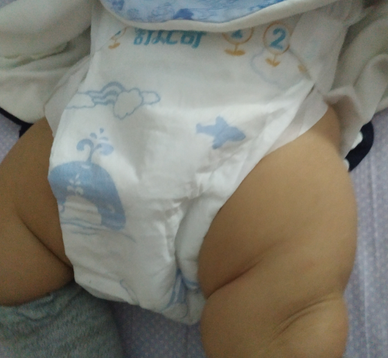 舒比奇魔力雙吸適合夏天用嗎 舒比奇魔力雙吸紙尿褲怎么樣