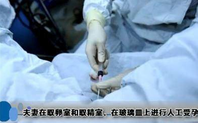 做試管嬰兒疼不疼 做試管嬰兒去哪里好