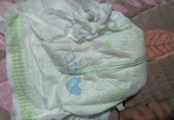 愛寶氏臻享紙尿褲紅屁股嗎 愛寶氏臻享紙尿褲使用測評