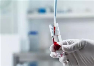 臍帶血有必要存嗎 哪些人更需要存臍帶血