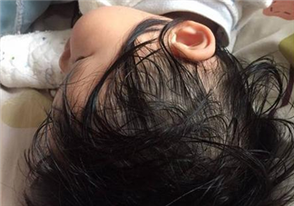 寶寶睡覺出汗是生病了嗎 寶寶出汗多是缺什么元素嗎