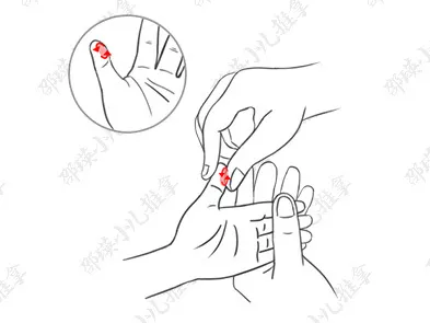 孩子過分喜歡甜食怎么辦 如何用推拿手法幫他戒糖