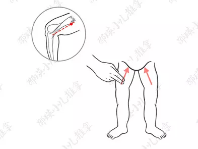 小兒疳證怎么給孩子推拿恢復(fù) 如何調(diào)理小兒疳證的孩子