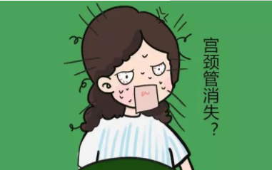 宮頸管消失是什么意思 宮頸管消失后多久分娩