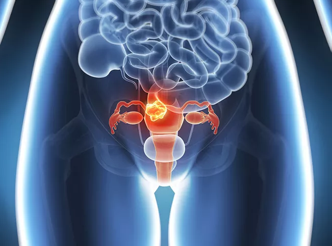 卵巢早衰和卵泡質量有什么關系 如何預防卵泡發育不成熟