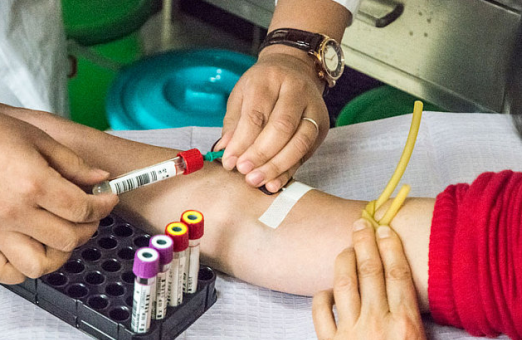 產后42天復查需要空腹嗎 產后復查注意事項 產后42天復查需要空腹嗎 產后復查注意事項