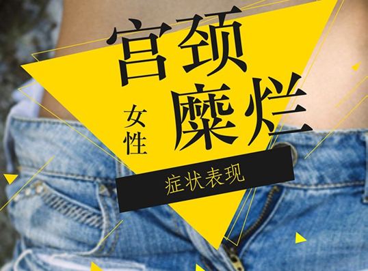 宮頸糜爛會(huì)變成宮頸癌嗎 有癥狀的宮頸糜爛怎么處理 宮頸糜爛會(huì)變成宮頸癌嗎 有癥狀的宮頸糜爛怎么處理