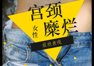 宮頸糜爛會變成宮頸癌嗎 有癥狀的宮頸糜爛怎么處理