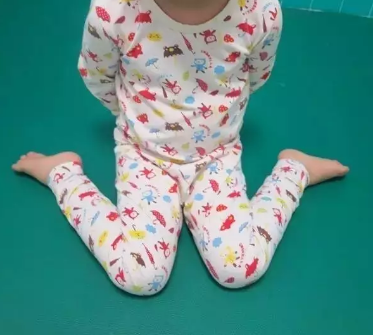 孩子走路內(nèi)八字是骨骼有問題嗎 孩子走路內(nèi)八字該怎么糾正