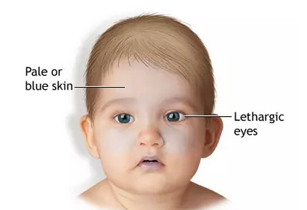 嬰兒搖晃綜合癥是什么 哄寶寶別搖晃寶寶 嬰兒搖晃綜合癥是什么 哄寶寶別搖晃寶寶