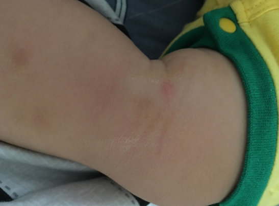 樂嬰泉紫草膏安全嗎 樂嬰泉紫草膏有什么味道