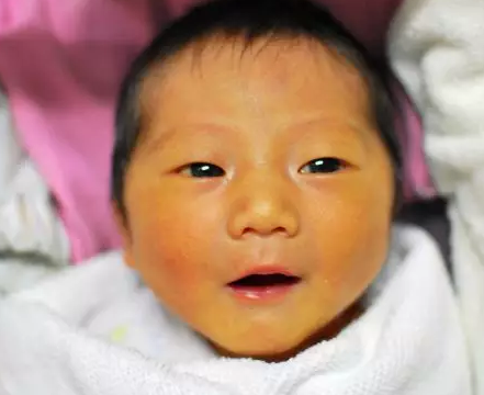 寶寶喝葡萄糖水去黃疸嗎 寶寶黃疸喝葡萄糖水好不好 寶寶喝葡萄糖水去黃疸嗎 寶寶黃疸喝葡萄糖水好不好