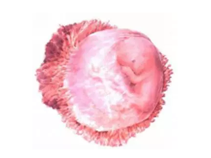 流產后再懷孕幾率大嗎 流產后再懷孕要注意什么