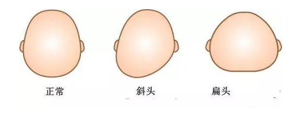 嬰兒正常頭型什么樣的 嬰兒正常頭型圖片正面?zhèn)让?><span>嬰兒正常頭型什么樣的 嬰兒正常頭型圖片正面?zhèn)让?/span></a></p>
             </div>
    <div   id=