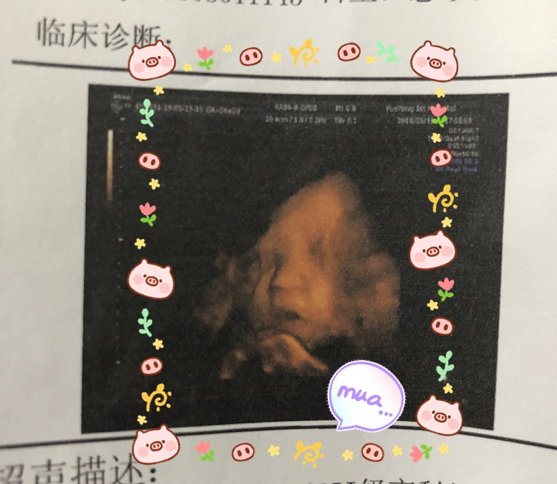 懷孕幸福說(shuō)說(shuō)心情短語(yǔ) 懷孕后感覺(jué)幸福說(shuō)說(shuō)朋友圈 懷孕幸福說(shuō)說(shuō)心情短語(yǔ) 懷孕后感覺(jué)幸福說(shuō)說(shuō)朋友圈