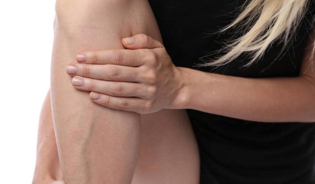 懷孕之后靜脈曲張是怎么回事 如何預(yù)防孕期靜脈曲張