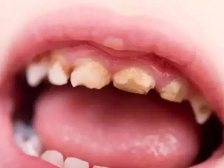 寶寶使用奶瓶有什么危害 寶寶奶瓶用到什么時候