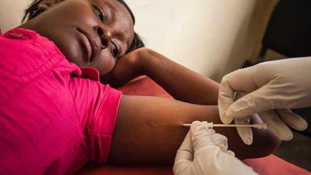 皮下埋值避孕手術(shù)什么時候做合適 皮埋避孕法的副作用