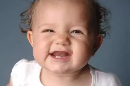 出牙晚是缺鈣嗎 孩子出牙晚是什么情況