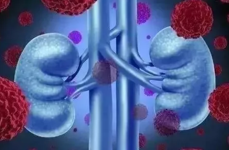 女性腎炎什么情況下能要孩子 女性腎炎懷孕了要注意什么 女性腎炎什么情況下能要孩子 女性腎炎懷孕了要注意什么