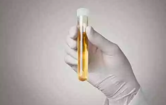 腎炎懷孕后期會怎么樣 為什么說腎炎懷孕有生命危險呢