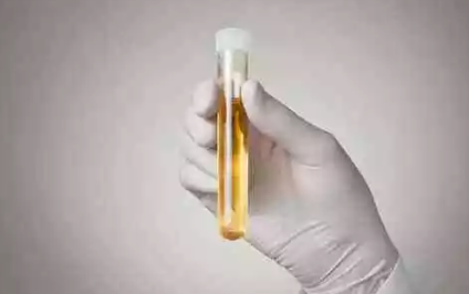 腎炎懷孕飲食禁忌大全 腎炎懷孕有什么影響