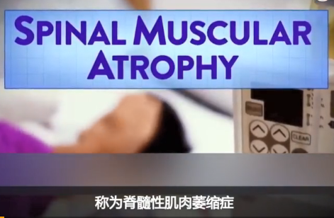 小兒脊髓性肌肉萎縮基因療法價格 史上最貴藥一支1448萬元