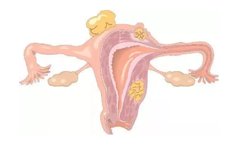 嘴唇長(zhǎng)胡須容易不孕嗎 女人長(zhǎng)胡須和卵巢健康有關(guān)嗎