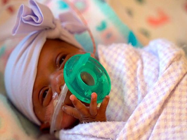 最小存活嬰兒出院 世界最小存活嬰兒多重