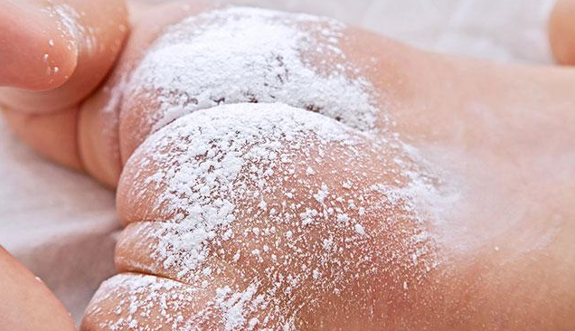 寶寶長痱子可以用爽身粉嗎 寶寶長痱子如何防治