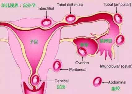 預防宮外孕的運動有哪些 跳繩能夠預防宮外孕嗎