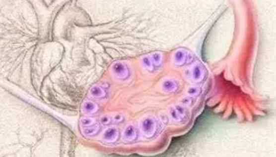 卵巢多囊樣改變會影響懷孕嗎 多囊卵巢綜合癥好懷孕嗎