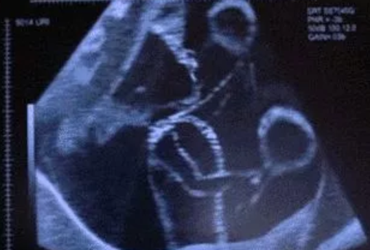 需要在固定的時間數胎動嗎 懷孕數胎動時間早上還是晚上